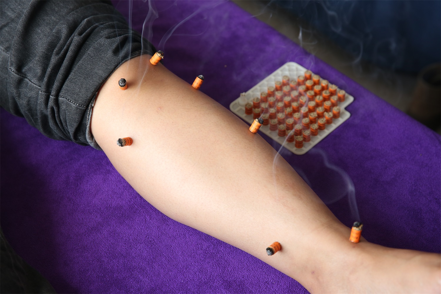 Paper Tube Moxibustion (Strong and Weak)